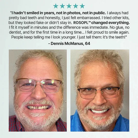 Superbuyg™ custom-made, full-featured dentures for greater confidence
