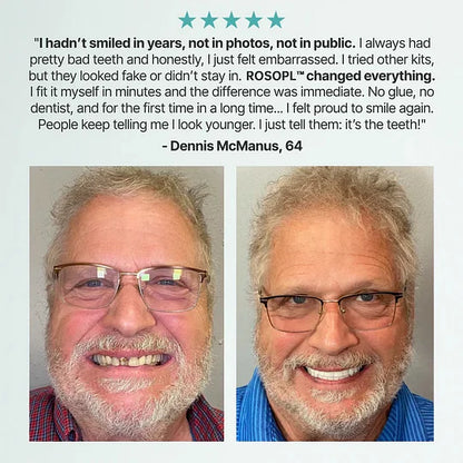 Superbuyg™ custom-made, full-featured dentures for greater confidence